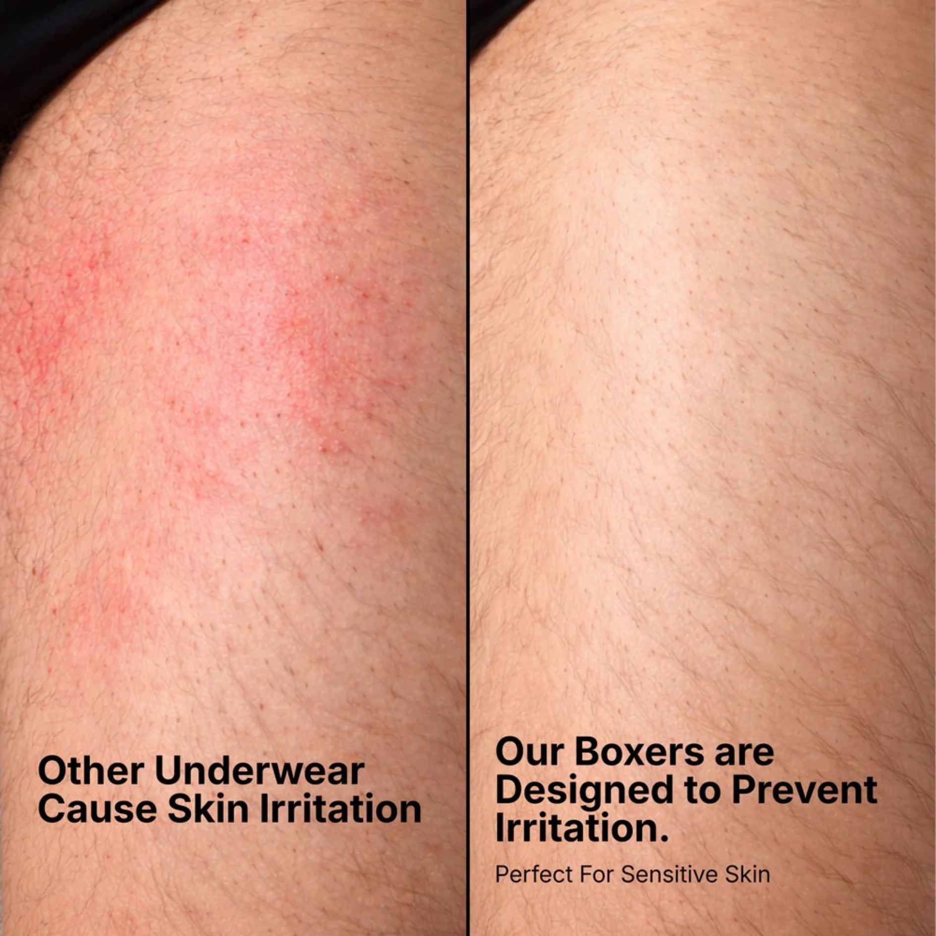 Hello Mesh Boxers 5-Pack Black | + 5 FREE